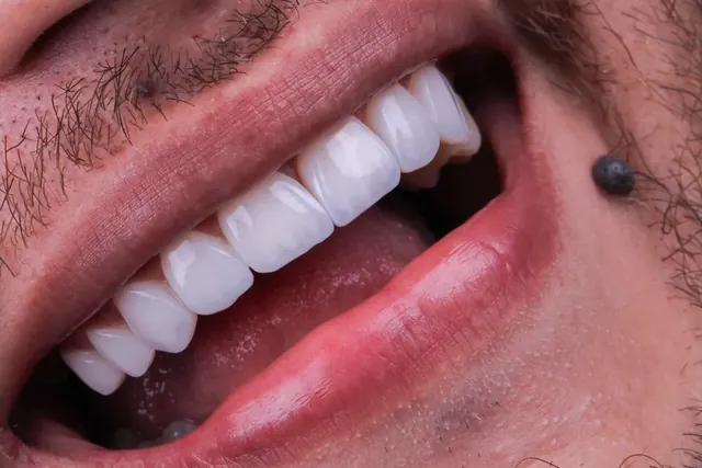 Sorriso masculino com lentes, em macro